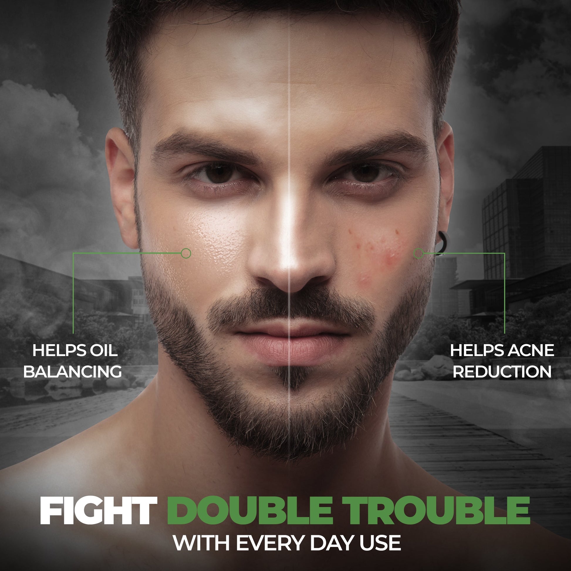 Beardo Acne Control Combo