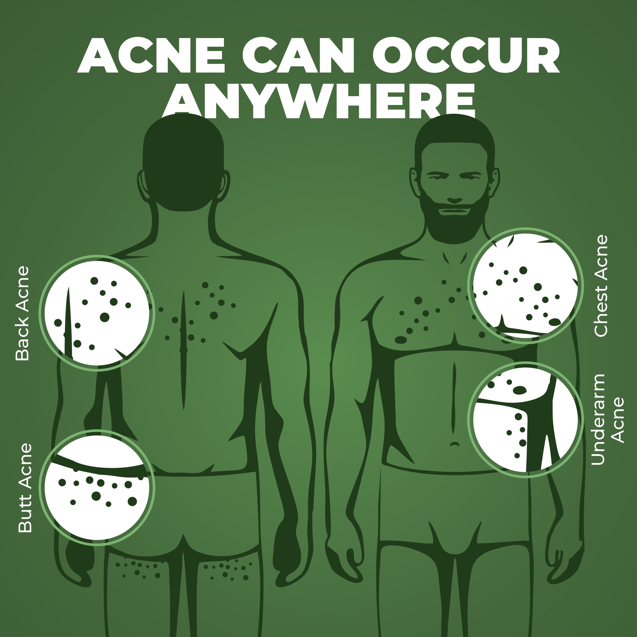 Beardo Acne Control Combo