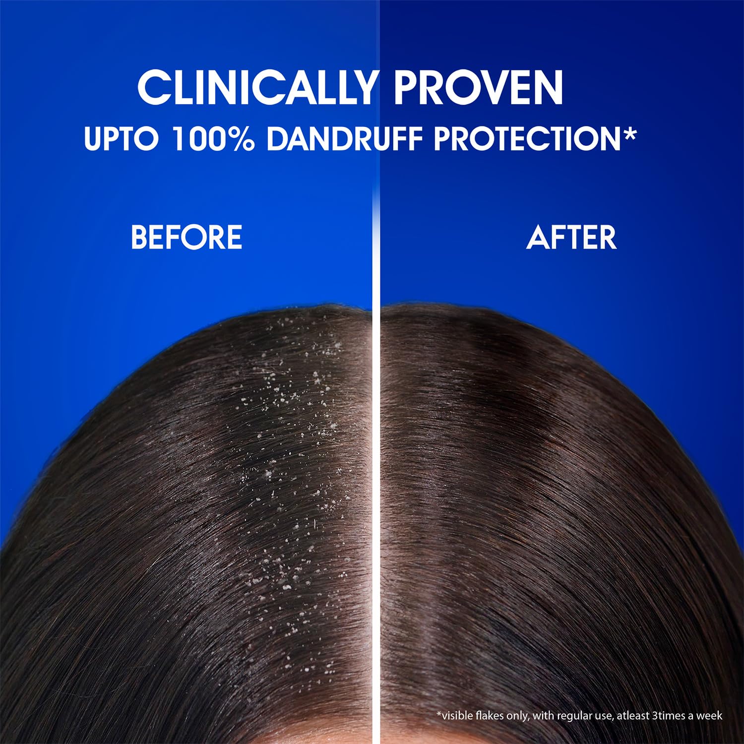 Head & Shoulders Anti-Dandruff Anti-Hairfall Shampoo for 340ml