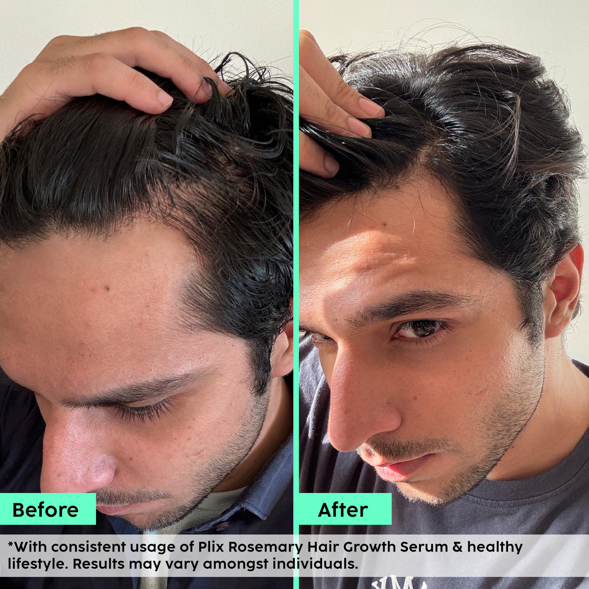 Rosemary Male Hair Care Regime