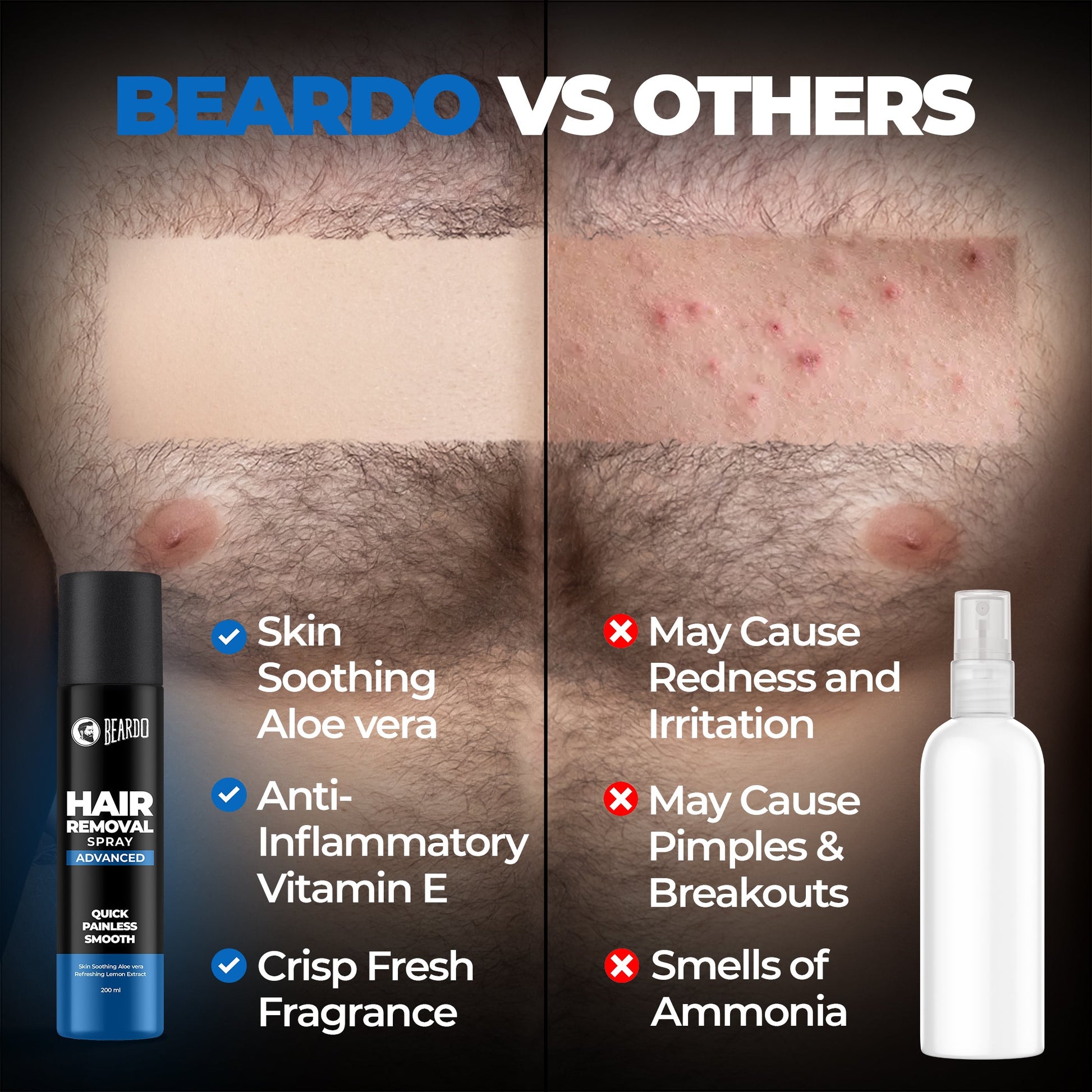 Beardo Advanced Hair Removal Spray